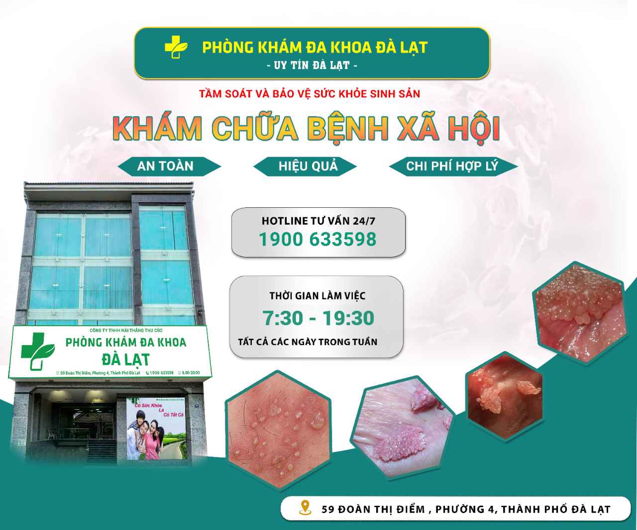 Hình ảnh minh họa